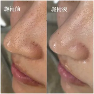 毛穴専門店アイミュー mamiのエステ・リラクイメージ