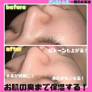 痩身&美肌サロン 堀米✨のその他イメージ