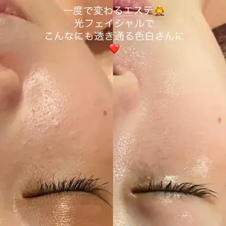 毛穴から始める肌メン テマンダリンオレンジのエステ・リラクイメージ