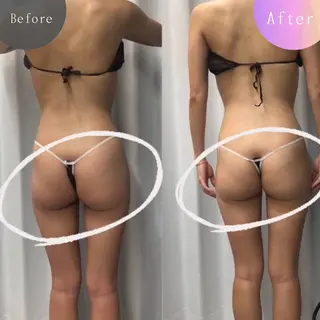 痩身・脱毛・肌管理 Rechica心斎橋のエステ・リラクイメージ