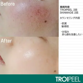 Hémireve Shirokane所属・トロイアルケ🩵 美眉EMIの眉毛・アイブロウイメージ