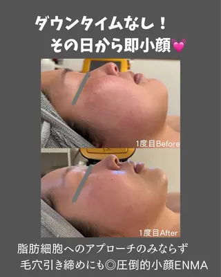 BLOSSOM 菊地のエステ・リラクイメージ