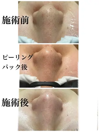 beauty salon  nana所属・beauty salon　nanaのエステ・リラクイメージ