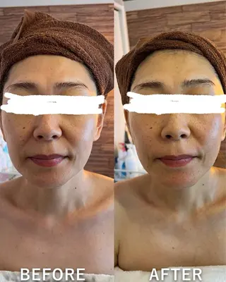 🌞シミケアサロン @SUNiko🌴のエステ・リラクイメージ