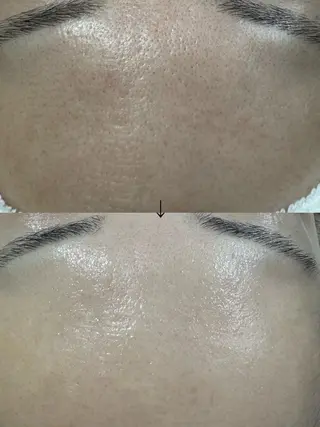 beautysalon LIMOA所属・松本 愛絵理のエステ・リラクイメージ