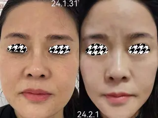 ネイル aliaハーブ水光店 エステティシャン募集のエステ・リラクイメージ