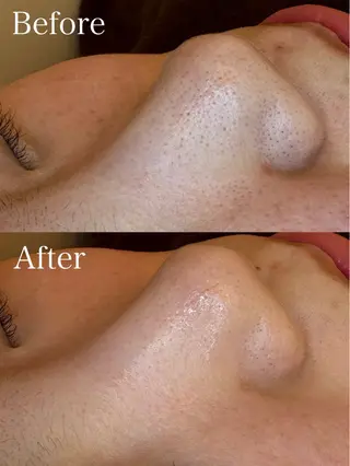 🤍アベシュリ /フェイシャル🤍のエステ・リラクイメージ