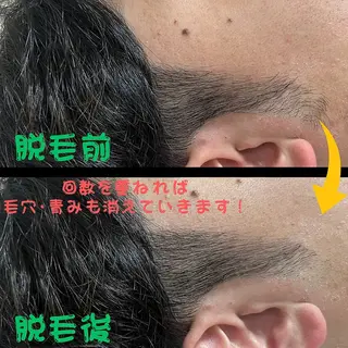 メンズ キッズ メンズ脱毛 FELISSE【フェリッセ】所属・メンズ脱毛フェリッセ /男女🆗キッズ🆗のエステ・リラクイメージ