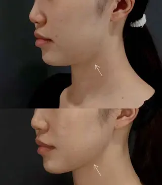 マツエク・マツパ aliaハーブ水光店 エステティシャン募集のエステ・リラクイメージ