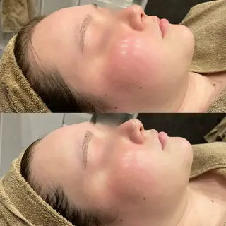 Re:Belle 久留米 : 中島のエステ・リラクイメージ