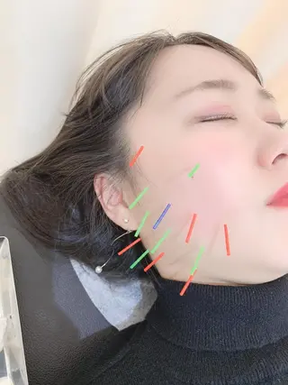 小林整骨院 天六 水侍 徹のエステ・リラクイメージ