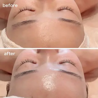 mignon /まつげパーマ・小顔のマツエク・マツパデザイン