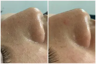 ize 横浜店のエステ・リラクイメージ