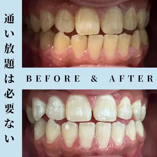 メンズ セルフホワイトニング Dolce水戸店のその他イメージ