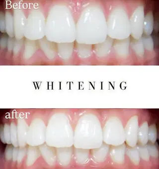 Luv the TERRACEの眉毛・アイブロウイメージ