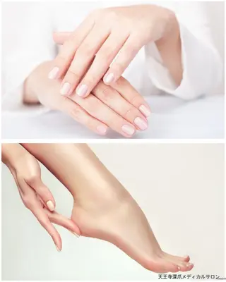 ネイル 天王寺 深爪メディカルサロンのネイルデザイン