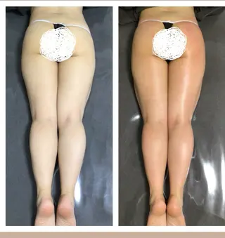 セルライトクラッシュ ＆腸もみ＋骨盤矯正のその他イメージ