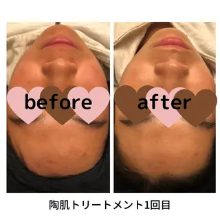 身体の土台作り necorobiのエステ・リラクイメージ