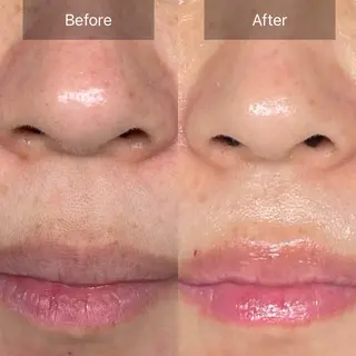 loa まつ毛と肌管理のお店のマツエク・マツパデザイン