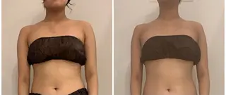 リンパマッサージ&ピラティスmimoza所属・リンパマッサージ mimozaのエステ・リラクイメージ