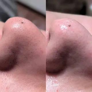 【Morphome】 ﾓﾙﾌｫﾑのエステ・リラクイメージ