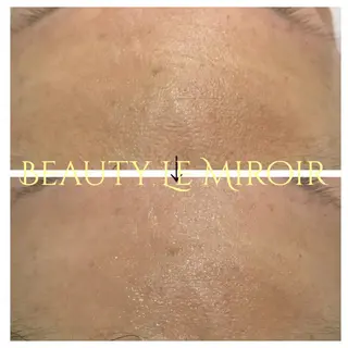 ビューティー ミロワールのエステ・リラクイメージ