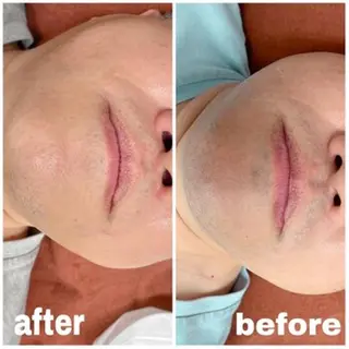 メンズ メンズビューティー 池村哲雄のエステ・リラクイメージ