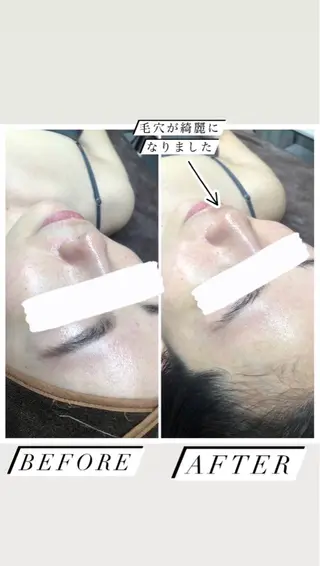 痩身・脱毛・肌管理 Rechica心斎橋のエステ・リラクイメージ