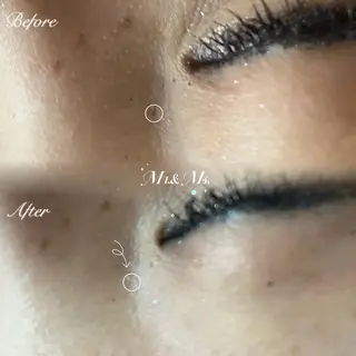 Mr.&Ms.脱毛 /毛穴洗浄 YUNAのその他イメージ