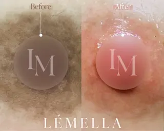 お手入れ眉/小顔 /プライベートサロンのエステ・リラクイメージ