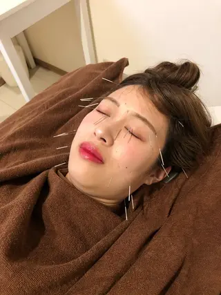 SBHメディカル美容サロン所属・🐱美容鍼・整体 SBHメディカル👍のエステ・リラクイメージ