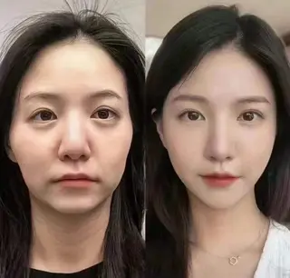 マツエク・マツパ aliaハーブ水光店 エステティシャン募集のエステ・リラクイメージ