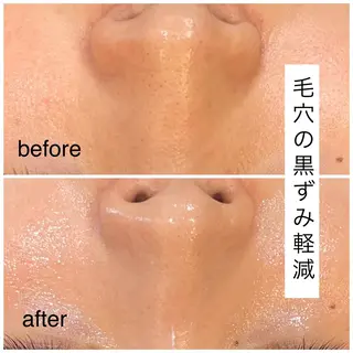 leolo武蔵浦和 肌質改善&脱毛のエステ・リラクイメージ