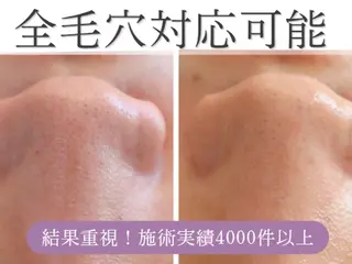 エステサロン NICOLIのエステ・リラクイメージ