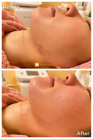 Lila プライベートサロンのエステ・リラクイメージ