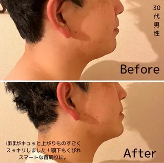 表情筋フェイシャル 三軒茶屋のエステ・リラクイメージ