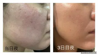 🤍Linola🤍 レイビス 須藤のエステ・リラクイメージ