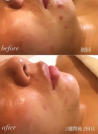 エステティックルーム Beauce.のエステ・リラクイメージ