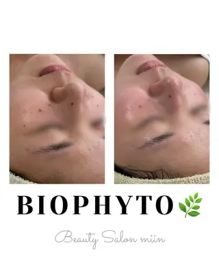 韓国肌管理 白玉肌管理®︎のエステ・リラクイメージ