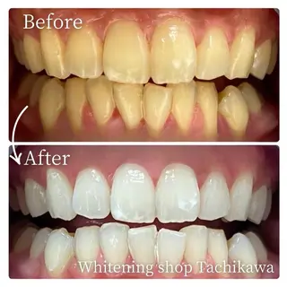 セルフ　ホワイト ニングショップ立川のその他イメージ