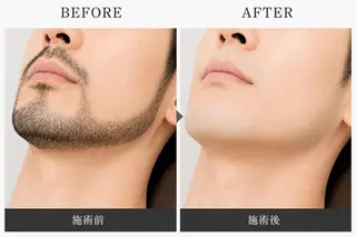 眉毛ぐせ改善サロン airy junの眉毛・アイブロウイメージ