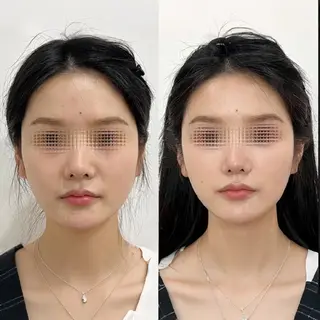 aliaハーブ水光店 エステティシャン募集のエステ・リラクイメージ