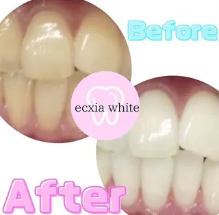 nanami -ホワイトニングのその他イメージ