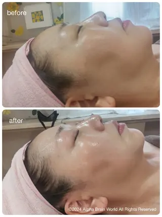 脱毛/美肌【皮膚科看 護師経営】ラベニールのエステ・リラクイメージ