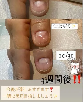 ネイル レナークアリア ネイリスト高橋のネイルデザイン