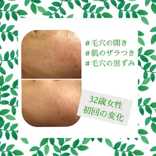 ミディアム カラー パーマ ヘアアレンジ メンズ キッズ ネイル マツエク・マツパ ニキビ・肌質改善専門 ♡人生が変わるサロンのエステ・リラクイメージ