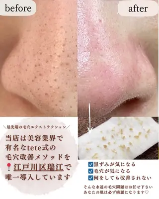 【毛穴専門店】 瑞江|yukaのエステ・リラクイメージ