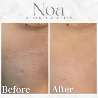 肌質改善サロン Noaのエステ・リラクイメージ