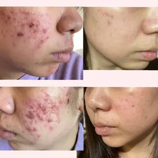 フェイシャルサロン ステラのエステ・リラクイメージ