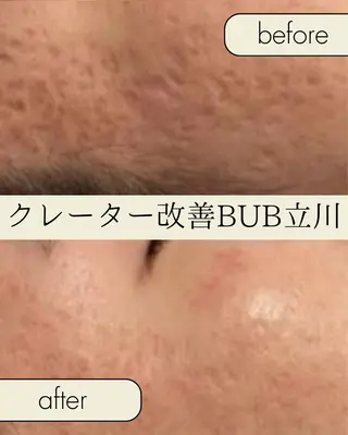 【BUB立川】 ゆかのエステ・リラクイメージ